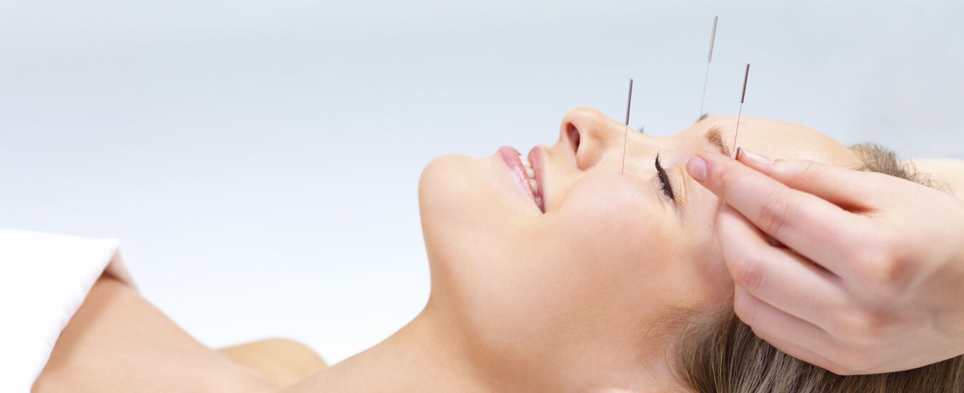Acupuncture-Therapy
